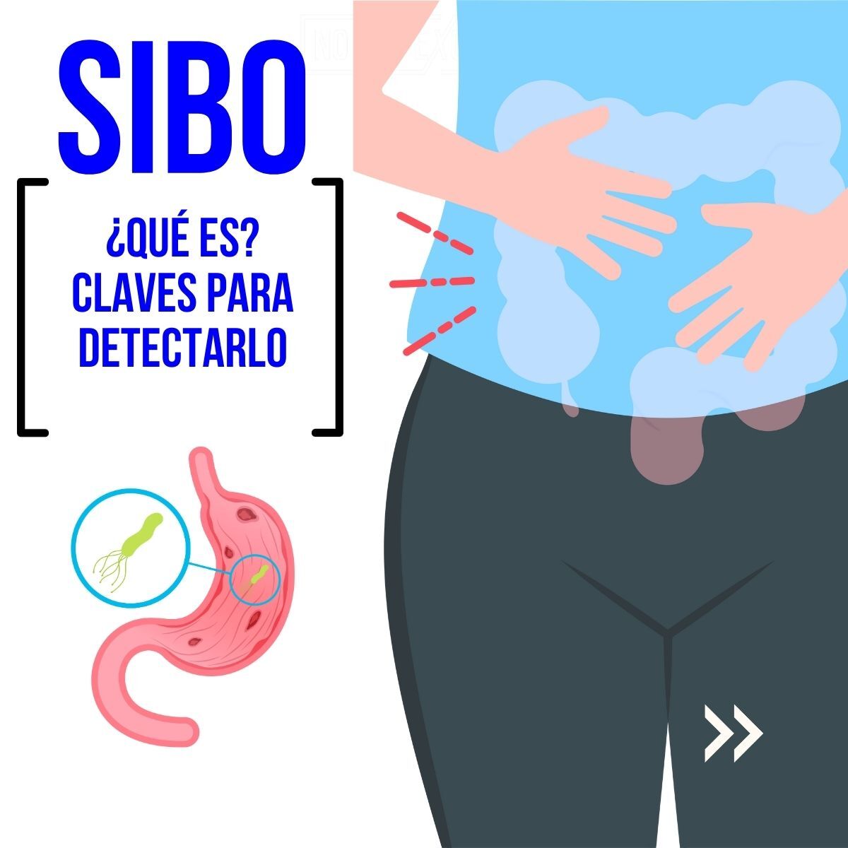 ¿qué es el SIBO? NO HAY EXCUSAS